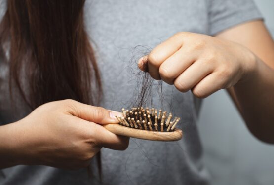 caída de pelo en mujeres y hombres